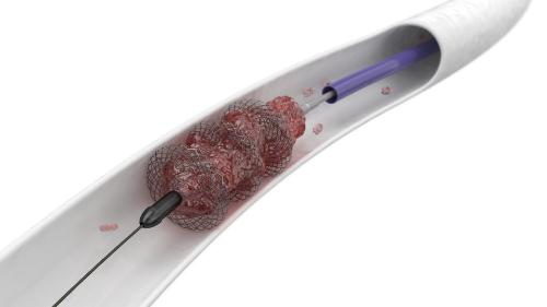 Inari Medical & Risalko S.A.